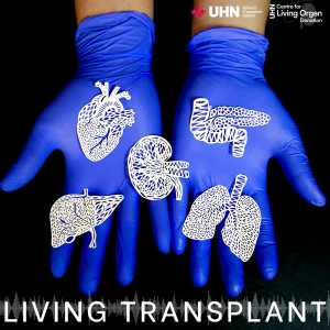 Living Transplant: Patient Stories | Organ Donation | Medical Experts