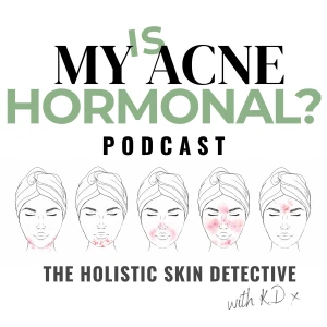 Is My Acne Hormonal?