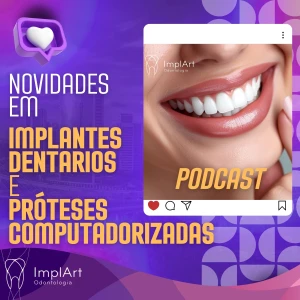 IMPLANTE DENTÁRIO PODCAST | Clínica ImplArt – Odontologia Digital e Implantes Dentários Modernos